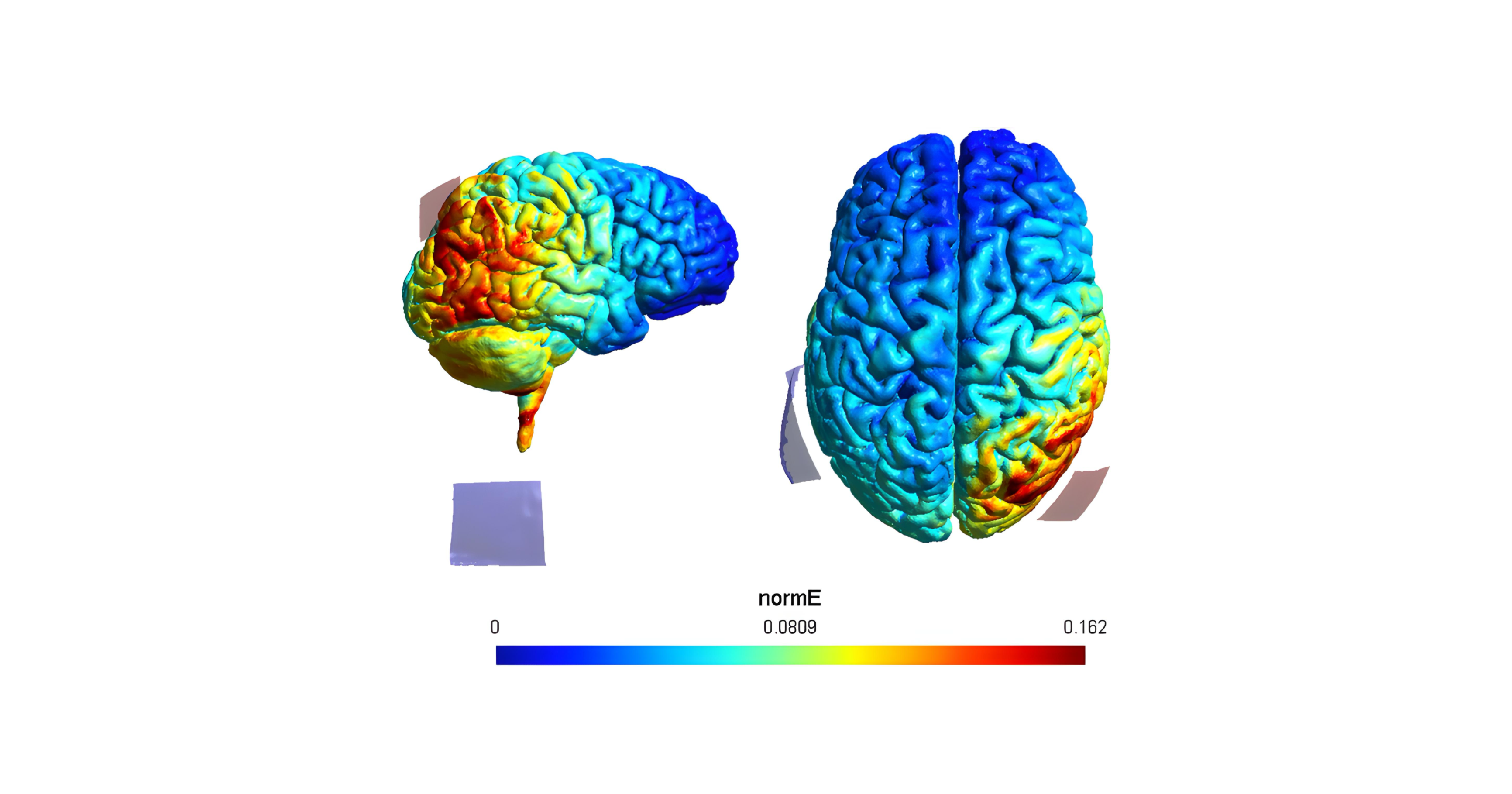 El Impacto de tDCS y CCT