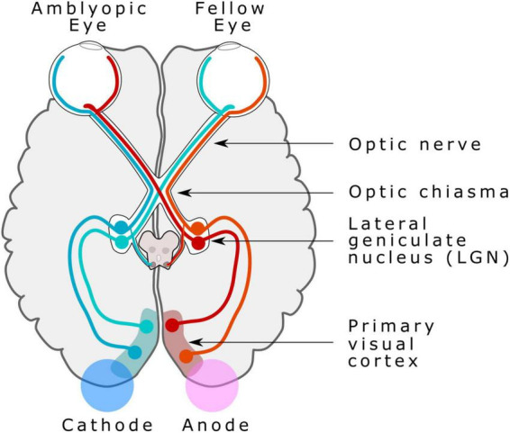 Diagrama tDCS